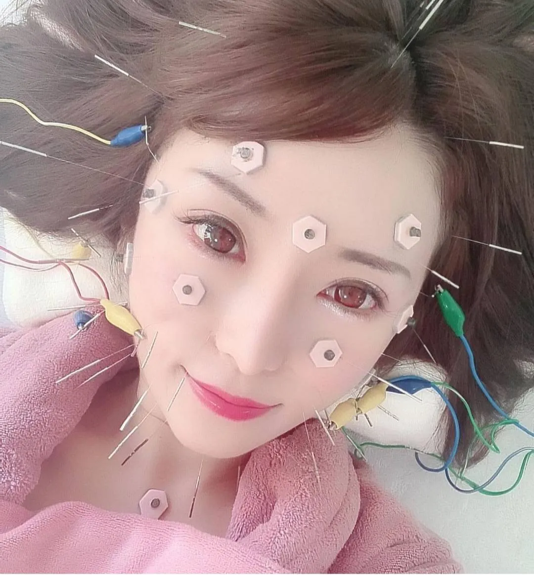 美针プリンセス《電気あり》(モテ顔)の施術イメージ