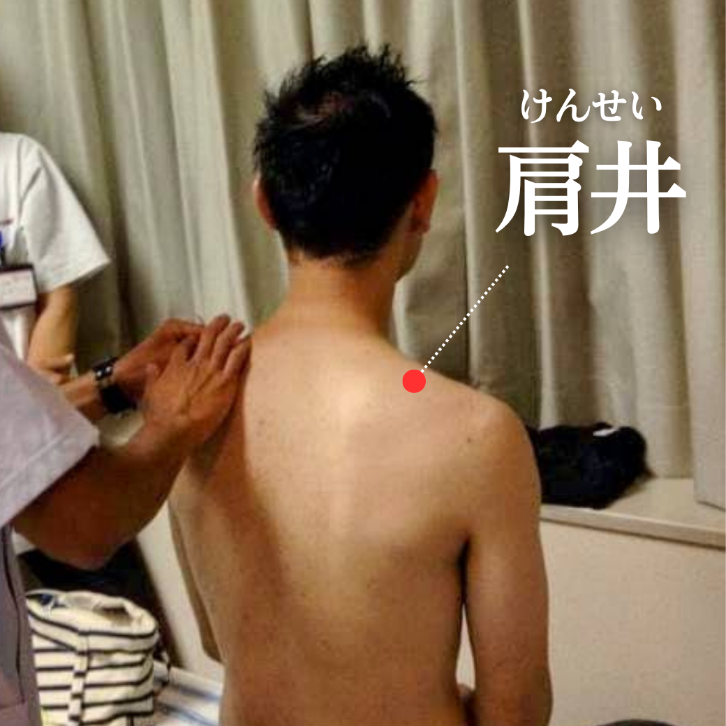 美容鍼灸サロン【镁针】名古屋の鍼灸施術イメージ