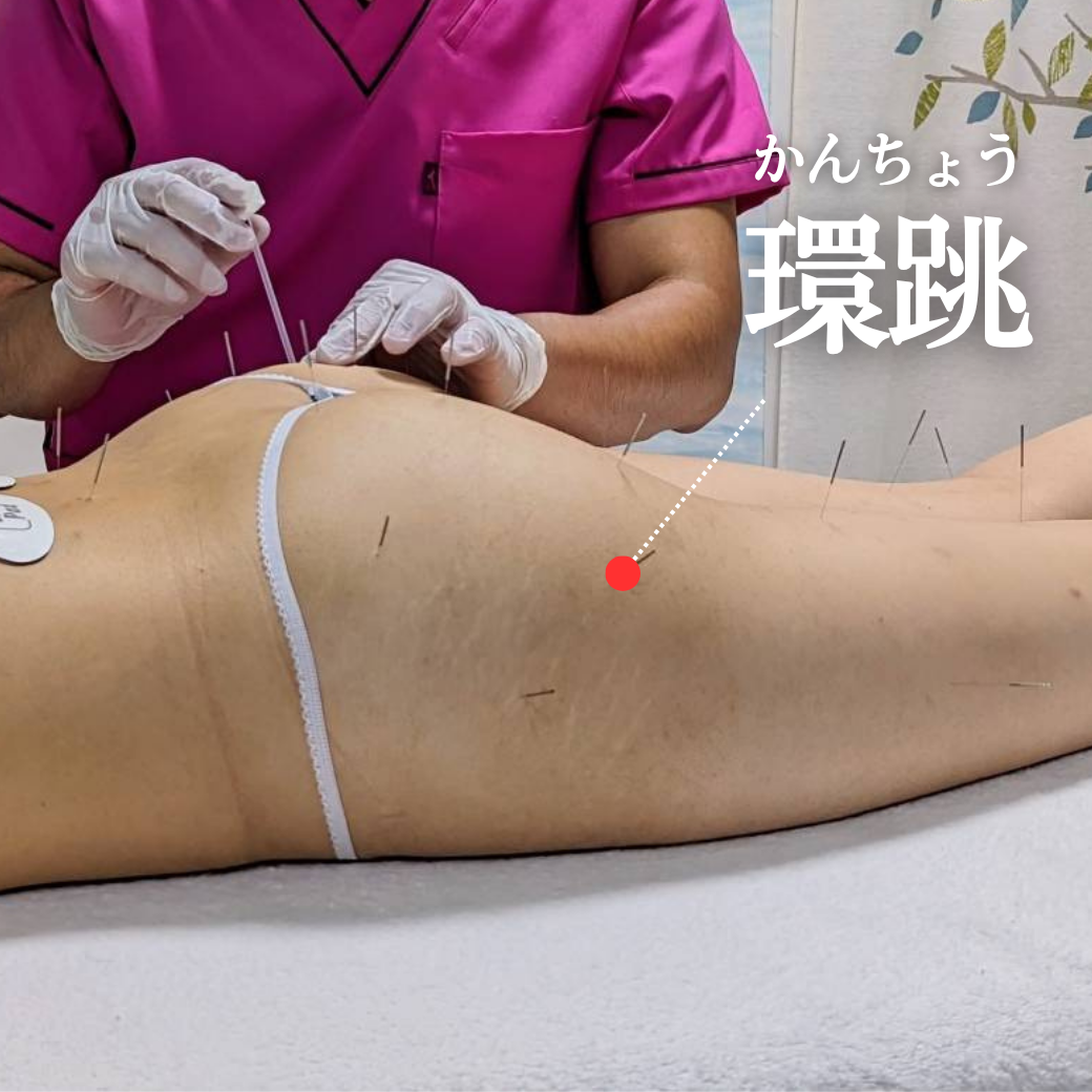 環跳(かんちょう)のツボを示した施術イメージ