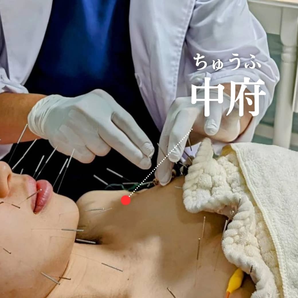 中府(ちゅうふ)のツボを紹介する画像