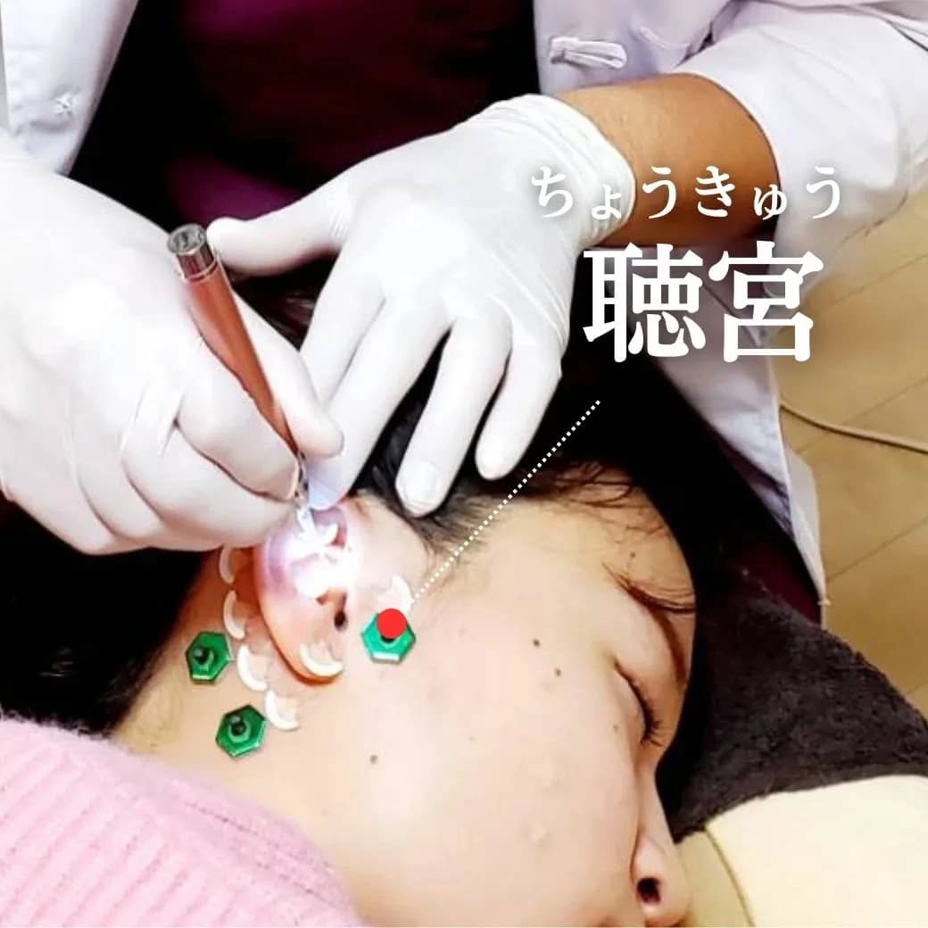 聴宮(ちょうきゅう)のツボを紹介する画像